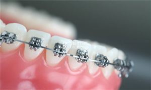 2021口腔正畸行業發展現狀及前景分析