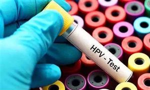 多地推進免費接種HPV疫苗 HPV疫苗存量市場空間有多大