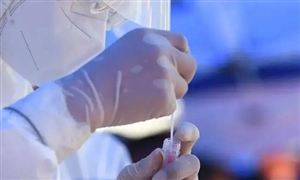 張文宏：未來抗疫靠3個武器 核酸檢測行業市場深度調研及投資策略預測