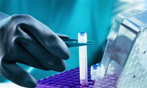 2022低溫等離子消融技術行業前景分析