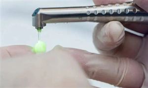 中國激光醫療行業市場深度調研及投資