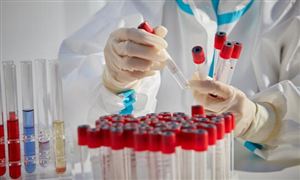 行業(yè)深度調(diào)研  2022POCT行業(yè)市場未來發(fā)展趨勢預(yù)測