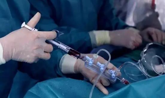 造影劑行業(yè)市場競爭現(xiàn)狀 中國造影劑行業(yè)投資趨勢預(yù)測