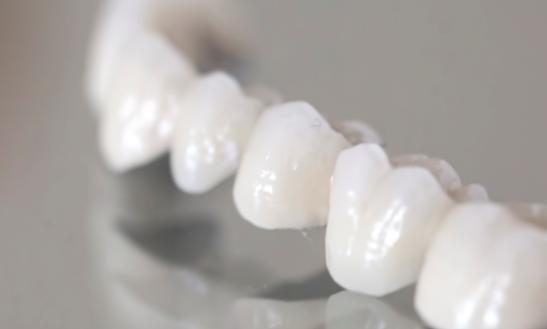 2023全瓷牙行業市場投資價值分析 未來潛在市場空間可達200億元