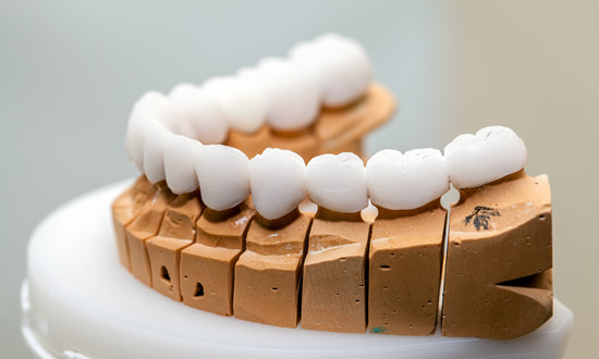 全瓷牙行業需求趨勢 全瓷牙行業投資前景規劃