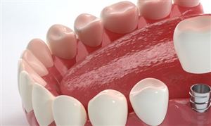 口腔醫療服務市場迎來發展新契機 2023口腔醫療市場現狀及前景分析