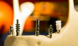 高純鈦市場深度全景調(diào)研及投資前景分析2023