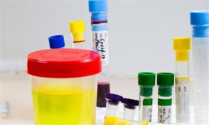 醫(yī)學(xué)檢驗行業(yè)發(fā)展現(xiàn)狀如何?醫(yī)學(xué)檢驗行業(yè)供需格局分析