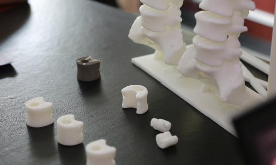 仿生骨行業發展現狀及前景研究