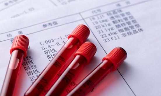 血液制品產業前景展望 未來行業的集中度會進一步提高