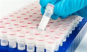 診斷試劑行業(yè)市場(chǎng)分析：到2024年我國(guó)體外診斷市場(chǎng)規(guī)模將達(dá)1957億元