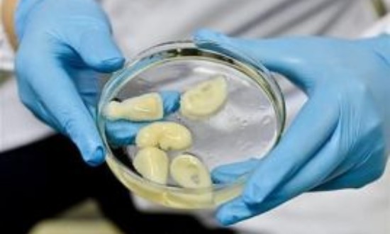 2024年中國生物醫(yī)用材料行業(yè)的產(chǎn)業(yè)鏈上下游結(jié)構(gòu)及市場發(fā)展現(xiàn)狀