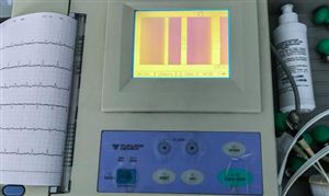 中國心電監護儀行業前景及市場競爭分析