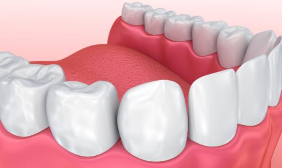 2025年中國口腔CBCT產業(yè)現(xiàn)狀與未來發(fā)展趨勢分析